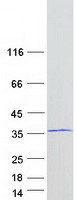 SLIM / FHL1 Protein - Purified recombinant protein FHL1 was analyzed by SDS-PAGE gel and Coomassie Blue Staining