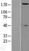 SLIT2 Protein - Western validation with an anti-DDK antibody * L: Control HEK293 lysate R: Over-expression lysate