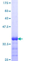 SLIT2 Protein - 12.5% SDS-PAGE Stained with Coomassie Blue.