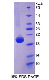 SLIT2 Protein