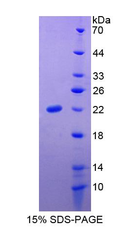 SLIT3 Protein - Recombinant Slit Homolog 3 By SDS-PAGE