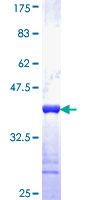 SLMAP / SLAP Protein - 12.5% SDS-PAGE Stained with Coomassie Blue.