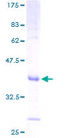 SLPI / Antileukoproteinase Protein - 12.5% SDS-PAGE of human SLPI stained with Coomassie Blue