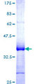 SLPI / Antileukoproteinase Protein - 12.5% SDS-PAGE Stained with Coomassie Blue.