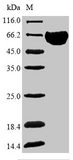 SLURP1 / ARS / MDM Protein - (Tris-Glycine gel) Discontinuous SDS-PAGE (reduced) with 5% enrichment gel and 15% separation gel.