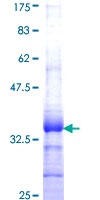 SLURP1 / ARS / MDM Protein - 12.5% SDS-PAGE Stained with Coomassie Blue.