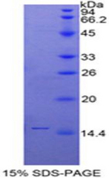 SLURP1 / ARS / MDM Protein - Recombinant Secreted Ly6/uPAR Related Protein 1 By SDS-PAGE