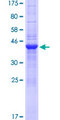 SLX1A / GIYD1 Protein - 12.5% SDS-PAGE of human GIYD1 stained with Coomassie Blue