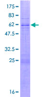 SLX1A / GIYD2 Protein - 12.5% SDS-PAGE of human GIYD2 stained with Coomassie Blue