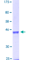 SMAD1 Protein - 12.5% SDS-PAGE Stained with Coomassie Blue.