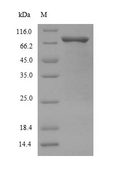 SMAD2 Protein - (Tris-Glycine gel) Discontinuous SDS-PAGE (reduced) with 5% enrichment gel and 15% separation gel.