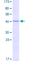SMAD2 Protein - 12.5% SDS-PAGE Stained with Coomassie Blue.
