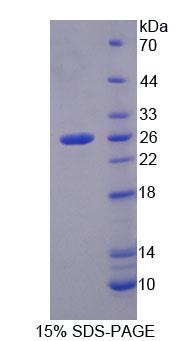 SMAD2 Protein - Recombinant Mothers Against Decapentaplegic Homolog 2 By SDS-PAGE