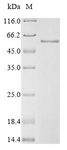 SMAD3 Protein - (Tris-Glycine gel) Discontinuous SDS-PAGE (reduced) with 5% enrichment gel and 15% separation gel.