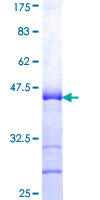 SMAD3 Protein - 12.5% SDS-PAGE Stained with Coomassie Blue.