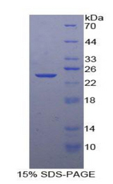 SMAD3 Protein - Recombinant Mothers Against Decapentaplegic Homolog 3 By SDS-PAGE