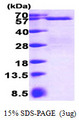 SMAD3 Protein