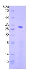 SMAD4 Protein - Recombinant Mothers Against Decapentaplegic Homolog 4 By SDS-PAGE