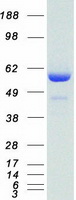 SMAD4 Protein - Purified recombinant protein SMAD4 was analyzed by SDS-PAGE gel and Coomassie Blue Staining