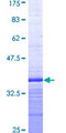 SMAD5 Protein - 12.5% SDS-PAGE Stained with Coomassie Blue.