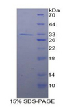 SMAD5 Protein - Recombinant Mothers Against Decapentaplegic Homolog 5 By SDS-PAGE