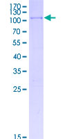 SMAD6 Protein - 12.5% SDS-PAGE of human SMAD6 stained with Coomassie Blue