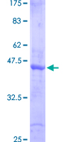 SMAD6 Protein - 12.5% SDS-PAGE Stained with Coomassie Blue.