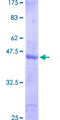 SMAD6 Protein - 12.5% SDS-PAGE Stained with Coomassie Blue.