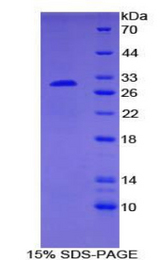 SMAD6 Protein - Recombinant Mothers Against Decapentaplegic Homolog 6 By SDS-PAGE