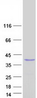 SMAD6 Protein - Purified recombinant protein SMAD6 was analyzed by SDS-PAGE gel and Coomassie Blue Staining
