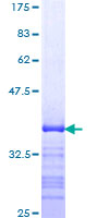 SMAD7 Protein - 12.5% SDS-PAGE Stained with Coomassie Blue