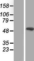 SMAD9 Protein - Western validation with an anti-DDK antibody * L: Control HEK293 lysate R: Over-expression lysate