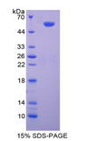 SMAD9 Protein - Recombinant Mothers Against Decapentaplegic Homolog 9 By SDS-PAGE