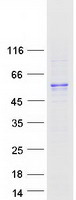 SMAD9 Protein - Purified recombinant protein SMAD9 was analyzed by SDS-PAGE gel and Coomassie Blue Staining