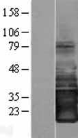 SMAGP Protein - Western validation with an anti-DDK antibody * L: Control HEK293 lysate R: Over-expression lysate