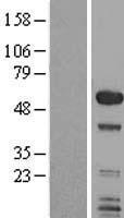 SMAP1 Protein - Western validation with an anti-DDK antibody * L: Control HEK293 lysate R: Over-expression lysate