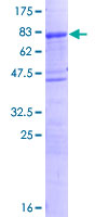 SMAP1 Protein - 12.5% SDS-PAGE of human SMAP1 stained with Coomassie Blue