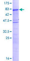 SMAP1 Protein - 12.5% SDS-PAGE of human SMAP1 stained with Coomassie Blue