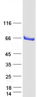 SMAP1 Protein - Purified recombinant protein SMAP1 was analyzed by SDS-PAGE gel and Coomassie Blue Staining