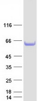 SMAP1 Protein - Purified recombinant protein SMAP1 was analyzed by SDS-PAGE gel and Coomassie Blue Staining