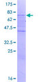 SMAP2 Protein - 12.5% SDS-PAGE of human SMAP1L stained with Coomassie Blue