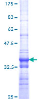 SMARCA2 / BRM Protein - 12.5% SDS-PAGE Stained with Coomassie Blue.