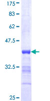 SMARCA3 / HLTF Protein - 12.5% SDS-PAGE Stained with Coomassie Blue.