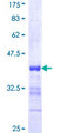 SMARCA3 / HLTF Protein - 12.5% SDS-PAGE Stained with Coomassie Blue.