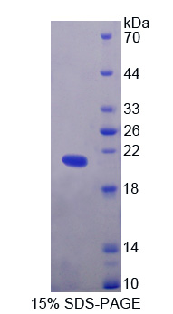 SMARCA3 / HLTF Protein - Recombinant  Helicase Like Transcription Factor By SDS-PAGE