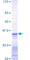 SMARCA4 / BRG1 Protein - 12.5% SDS-PAGE Stained with Coomassie Blue.