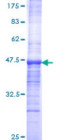 SMARCA5 / SNF2H Protein - 12.5% SDS-PAGE Stained with Coomassie Blue.