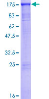 SMARCAD1 Protein - 12.5% SDS-PAGE of human SMARCAD1 stained with Coomassie Blue