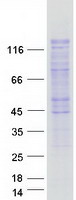SMARCAD1 Protein - Purified recombinant protein SMARCAD1 was analyzed by SDS-PAGE gel and Coomassie Blue Staining