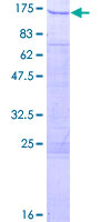 SMARCAL1 Protein - 12.5% SDS-PAGE of human SMARCAL1 stained with Coomassie Blue